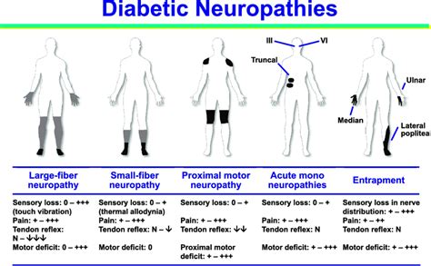 Diabetic Neuropathy Types Causes Treatment And More Hot Sex Picture