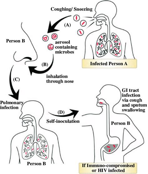 Tuberculosis Chain Of Infection