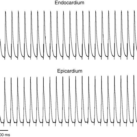 Representative Example Of Left Ventricular Endocardial And Epicardial
