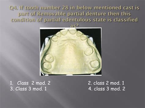 Ppt Partially Edentulous Arches Classification Powerpoint