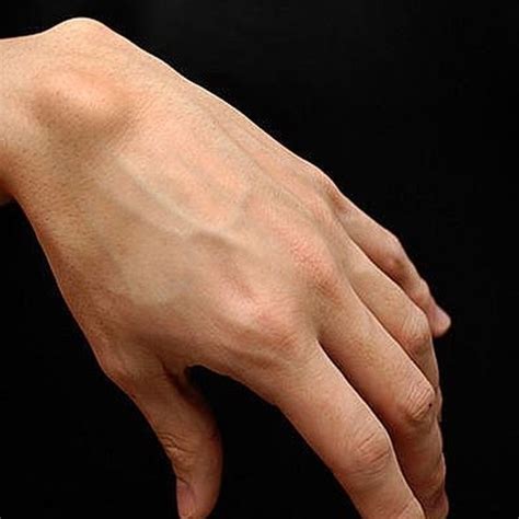 How To Know If Hand Or Wrist Pain Is A Ganglion Cyst Healthy Living