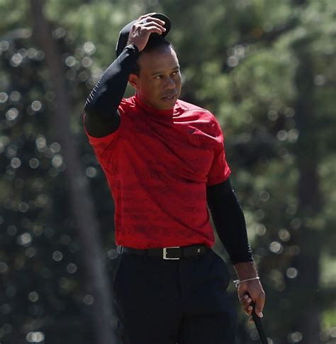 Rare Photo Shows Tiger Woods Leg Injury Which Fans Are Shocked At