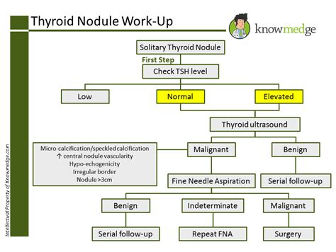 ABIM Exam Prep How To Work Up A Thyroid Nodule USMLE Internal