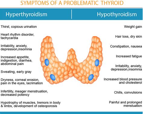 Thyrodism Overview Biology Ease