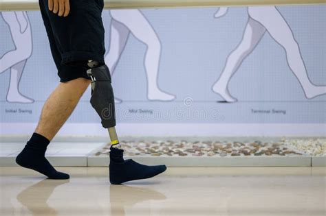 Athlete Man With Prosthetic Leg Walking At Health Care Center Stock