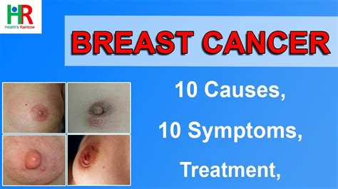 Breast Cancer Symptoms Causes Stages Signs Pictures Self Examination Treatment