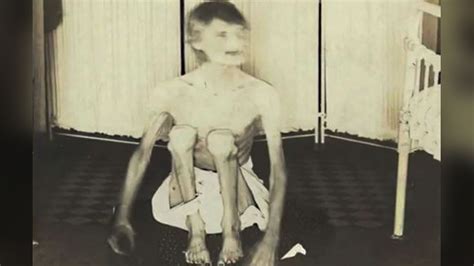 Rare Photos Taken From Old Insane Asylums Show Their Harsh Conditions YouTube