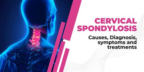 Understanding Spondylolisthesis Causes Symptoms And Treatment