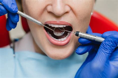Odontología Conservadora Smile Dentis