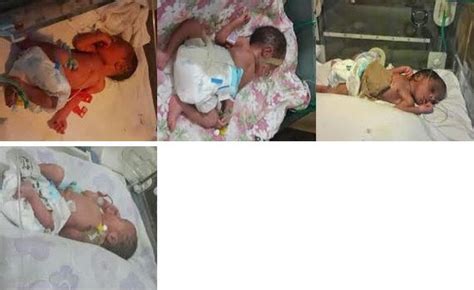 Woman Gives Birth To Five Babies At Once Information Nigeria