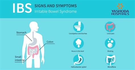 Irritable Bowel Syndrome Ibs Symptoms Causes Diagnosis Prevention