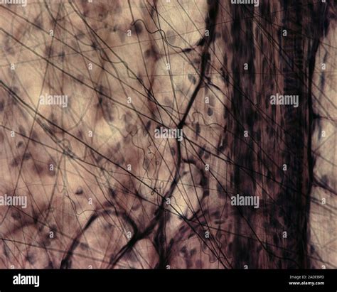 Areolar Loose Connective Tissue Light Micrograph This Type Of Loose