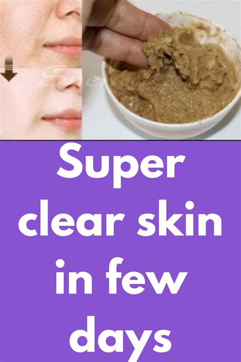 Super Clear Skin In Few Days This All Natural Homemade Clear Skin