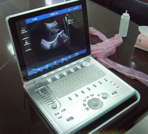 Portable Laptop Echocardiography Color Doppler Ultrasound Machine