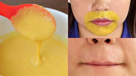 Do upper lip hair removal only after 16 years of age. How to Remove Hair from Upper Lip Naturally at Home?
