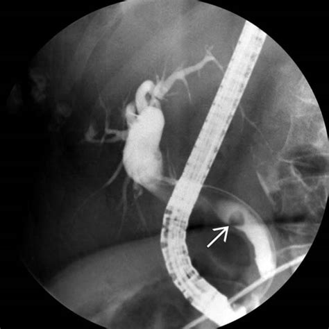 Imaging Approach To The Biliary System Radiology Key