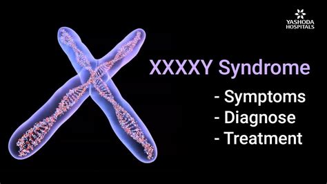49xxxxy Syndrome Symptoms Diagnosis And Treatment Health Tips Yashoda Hospitals Youtube