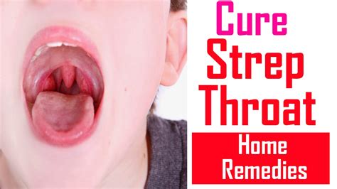Natural Home Remedies For Strep Throat How To Get Rid Of Sore Throat Youtube
