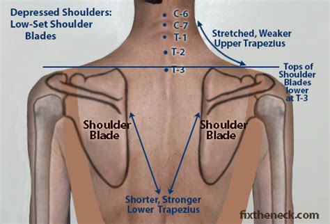 Some cases of pain between the shoulder blades are preventable. FST - Функционально-силовой тренинг: Fix The Shoulder ...