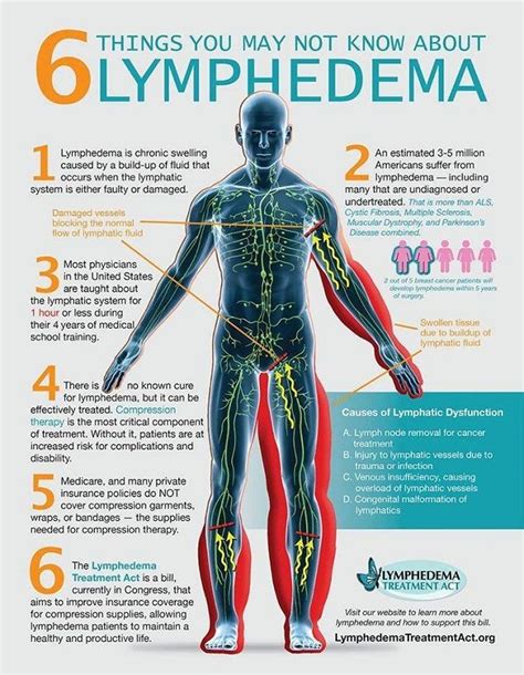 Pin On Lymphedema