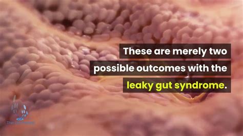 Leaky Gut Syndrome Youtube