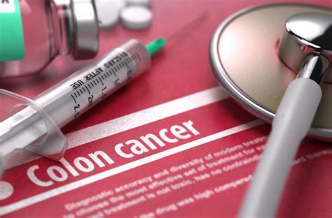 Chemotherapy Treatment For Colon Cancer