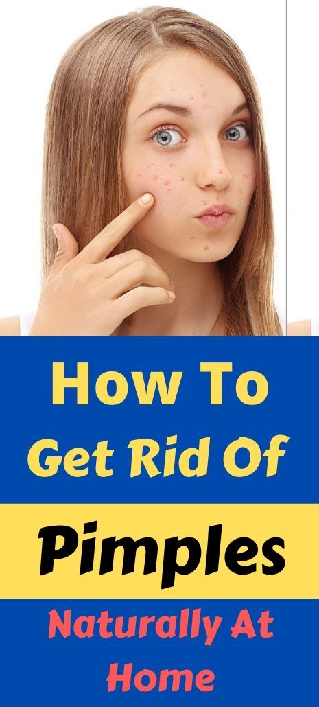How To Get Rid Of Pimples Naturally Overnight Fast Skincare