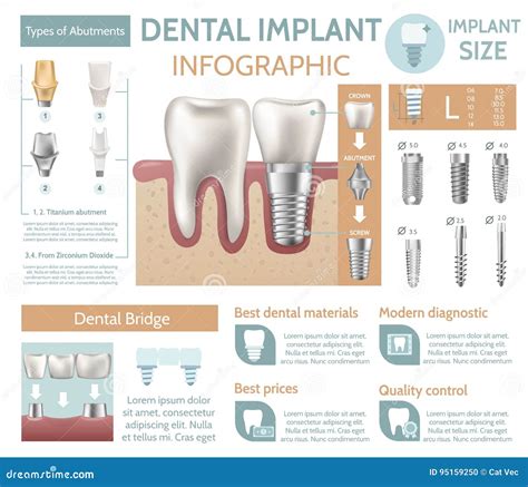 Illustrazione Infographic Di Vettore Del Manifesto Del Sito Web Della Clinica Del Dentista Del