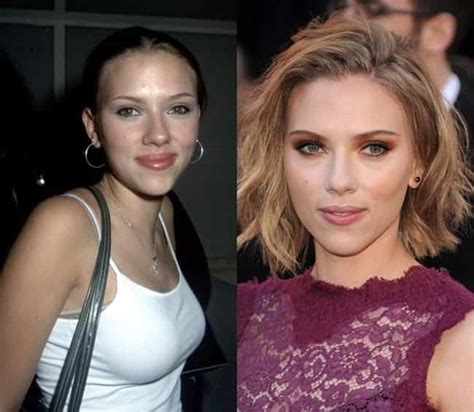 48 Celebrity Nose Jobs Before And After Viraluck