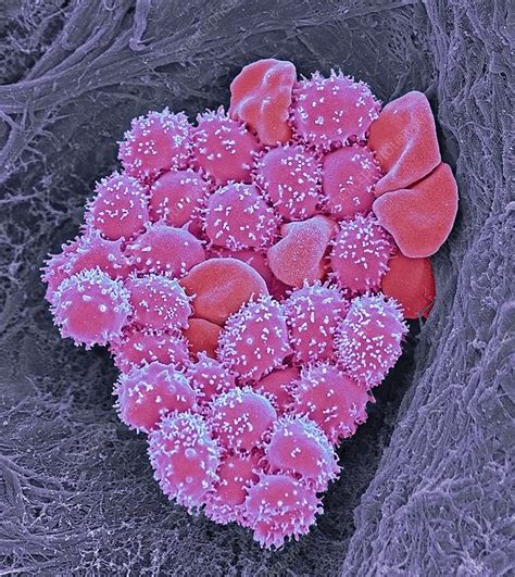 Crenate Red Blood Cells Sem Stock Image C0492779 Science Photo