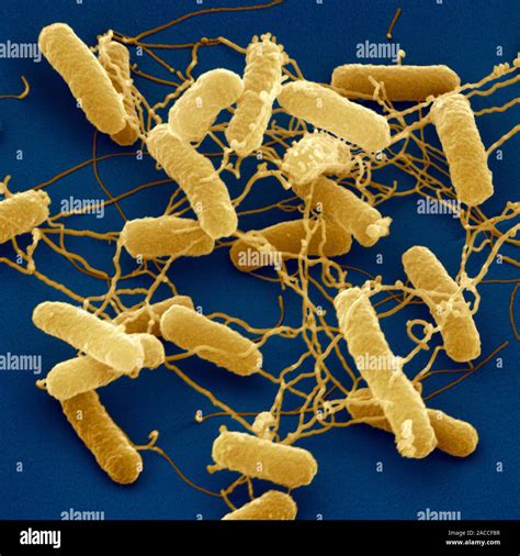 Salmonella Typhimurium Bacteria Coloured Scanning Electron Micrograph