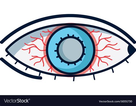 Eyes With Conjunctivitis Sickness And Infection Vector Image The Best