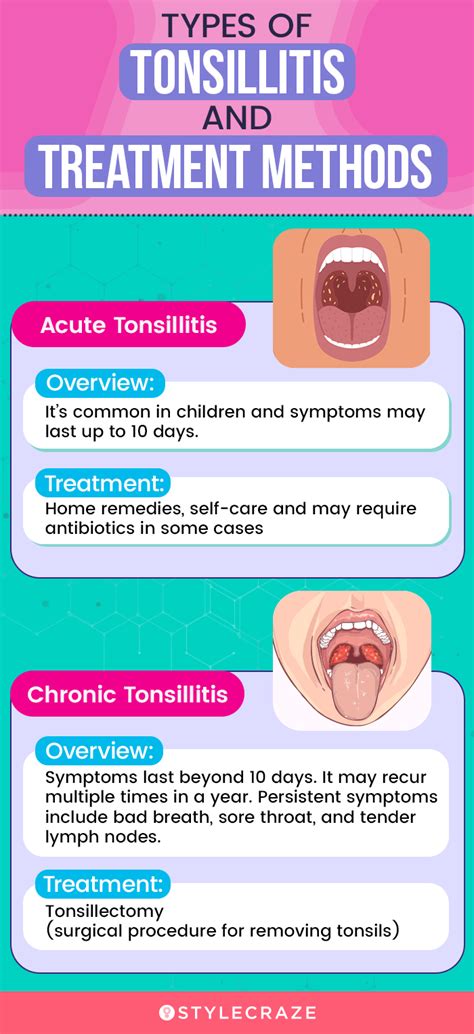23 Home Remedies For Tonsils Causes And Prevention Tips