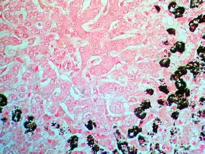 Histology Stains Nuclear Fast Red And Von Kossa Histology Slide