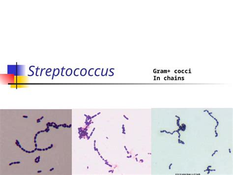 Ppt Streptococcus Gram Cocci In Chains Streptococci Gram Positive Cocci In Chains Lancefield