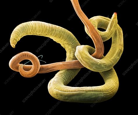 Parasitic Roundworms Sem Stock Image C0370818 Science Photo Library