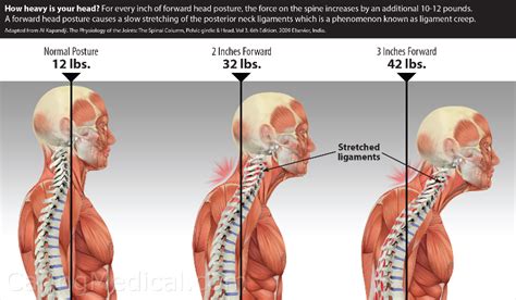 Symptoms And Conditions Of Craniocervical And Cervical Instability