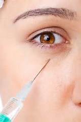 Fillers For Under Eye Bags Side Effects