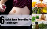Home Remedies For Rhabdomyolysis Images
