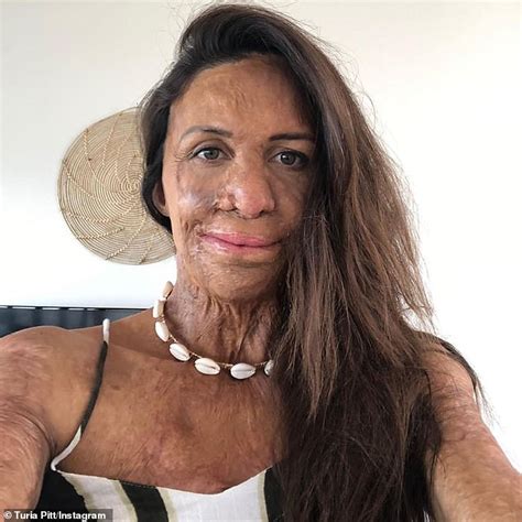 Inspirational Burns Survivor Turia Pitt Looks Back On Her Embarrassing Business Mistakes Daily