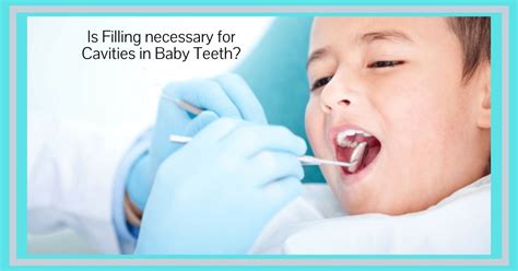 Is Filling Necessary For Caries In Baby Teeth Dental Caries In Babies