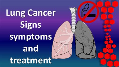 Lung Cancer Signs Symptoms And Treatment Youtube