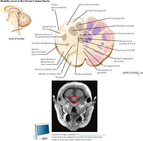 Brain Stem And Cerebellum Neupsy Key