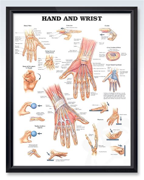 Hand And Wrist Exam Room Human Anatomy Poster Clinicalposters
