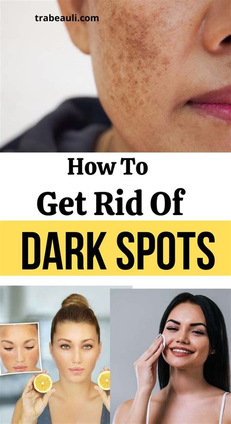 How To Get Rid Of Dark Spots Overnight With Home Remedies Trabeauli