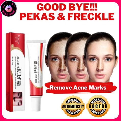 Original Melasma Cream Pekas Remover Effective Dark Spot And Freckles Remover Whitening Cream