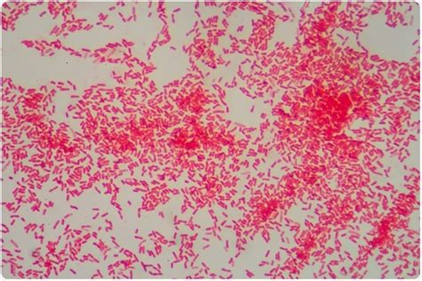 Cienciasmedicasnews Gram Negative Bacteria