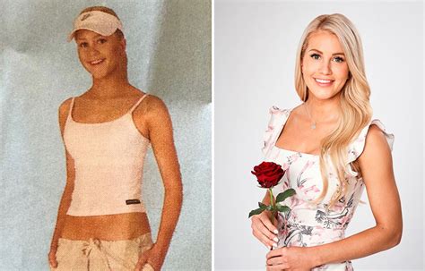 What Ali Oetjen Looked Like Before Surgery Girlfriend