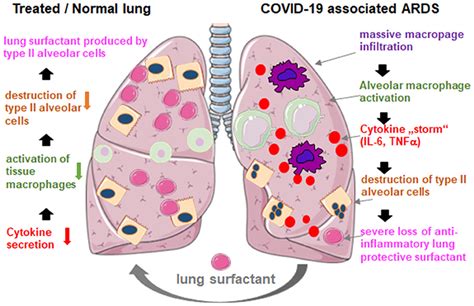 Frontiers Lung Surfactant For Pulmonary Barrier Restoration In