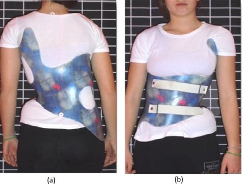 The Gensingen Brace Gbw For The Same Curve Pattern Double Major As